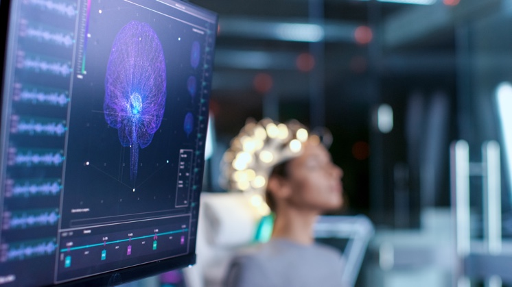 ¿Qué son los neuroderechos y por qué son vitales ante los avances en neurociencia?