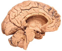 Cerebro humano